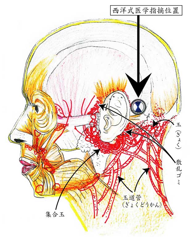  顔面神経痛（三叉神経痛・顔面痙攣）に見られる「ゴミ」の蓄積